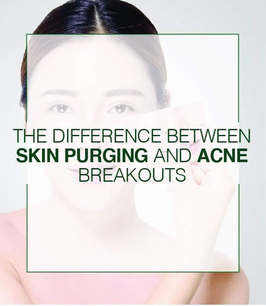 Breakouts Acne Vs Purging